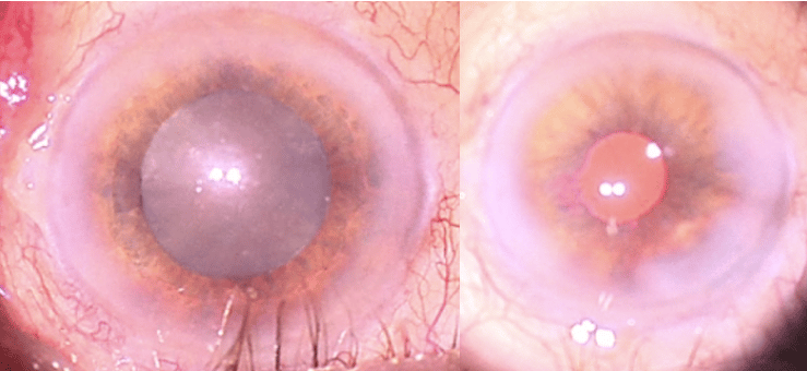 Slider image (6) Dr Nikolaos I Dervenis Eye Clinic